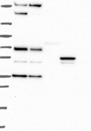 Western Blot: DPPIV/CD26 Antibody [NBP3-21319] -