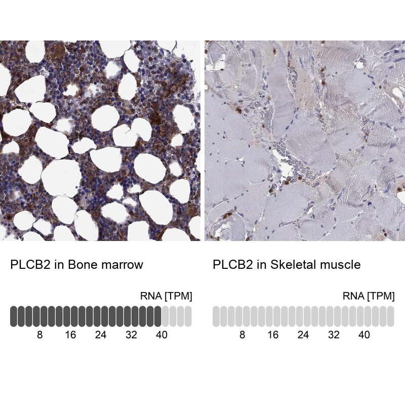 Immunohistochemistry-Paraffin: Phospholipase C beta 2 Antibody [NBP3-21325] -