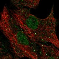 Immunocytochemistry/Immunofluorescence: PGLYRP1/PGRP-S Antibody [NBP3-21331] -