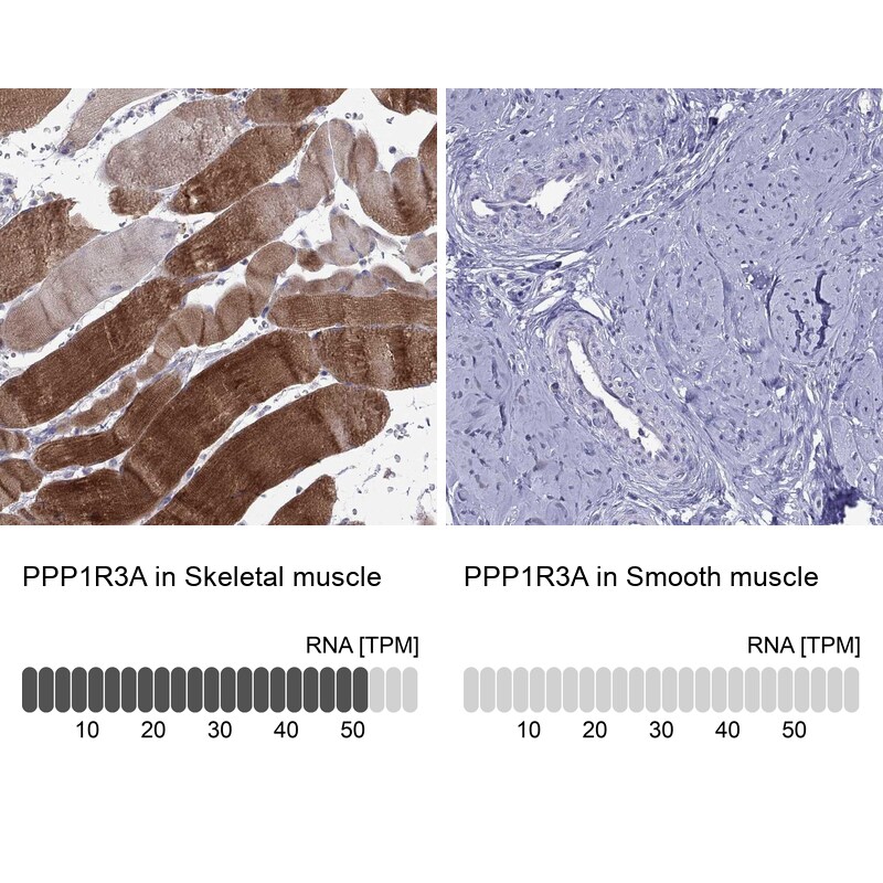 Immunohistochemistry-Paraffin: PPP1R3A Antibody [NBP3-21334] -