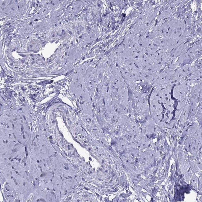 Immunohistochemistry-Paraffin: PPP1R3A Antibody [NBP3-21334] -