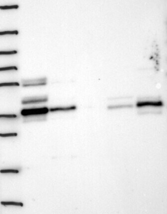 Western Blot: RPRD1B Antibody [NBP3-21336] -