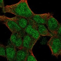 Immunocytochemistry/Immunofluorescence: Pin1 Antibody [NBP3-21340] -