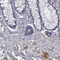 Immunohistochemistry-Paraffin: IL-10 Antibody [NBP3-21346] -