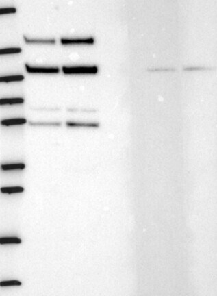 Western Blot: HDAC4+5+9 Antibody [NBP3-21347] -