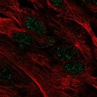 Immunocytochemistry/Immunofluorescence: Myocardin Antibody [NBP3-21348] -