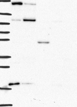 Western Blot: Cathepsin A/Lysosomal Carboxypeptidase A Antibody [NBP3-21355] -