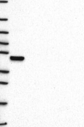 Western Blot: TDAG8/GPR65 Antibody [NBP3-21356] -