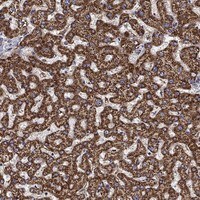 Immunohistochemistry-Paraffin: ALDH4A1 Antibody [NBP3-21358] -