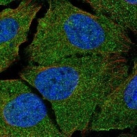 Immunocytochemistry/Immunofluorescence: LAP (TGF-beta 1) Antibody [NBP3-21360] -