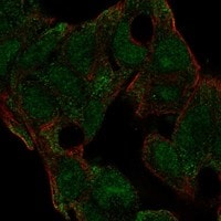 Immunocytochemistry/Immunofluorescence: Histamine N-Methyltransferase/HNMT Antibody [NBP3-21364] -