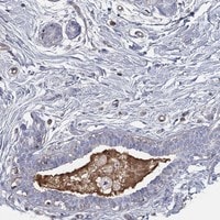 Immunohistochemistry-Paraffin: IFN-beta Antibody [NBP3-21365] -