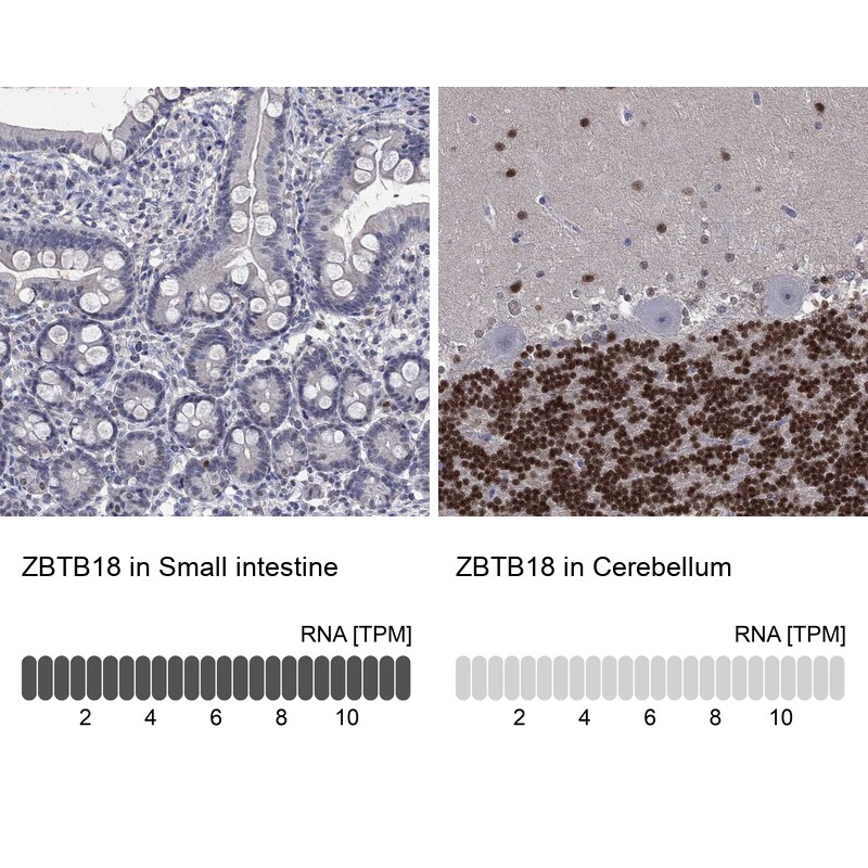 Immunohistochemistry-Paraffin: ZNF238 Antibody [NBP3-21367] -
