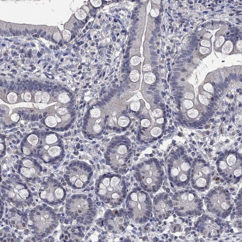 Immunohistochemistry-Paraffin: ZNF238 Antibody [NBP3-21367] -
