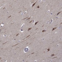 Immunohistochemistry-Paraffin: beta-1,3-Glucuronyltransferase 1/B3GAT1 Antibody [NBP3-21368] -