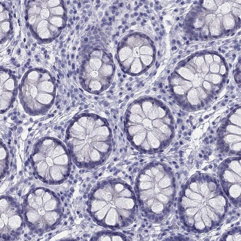 Immunohistochemistry-Paraffin: TRPM3 Antibody [NBP3-21371] -