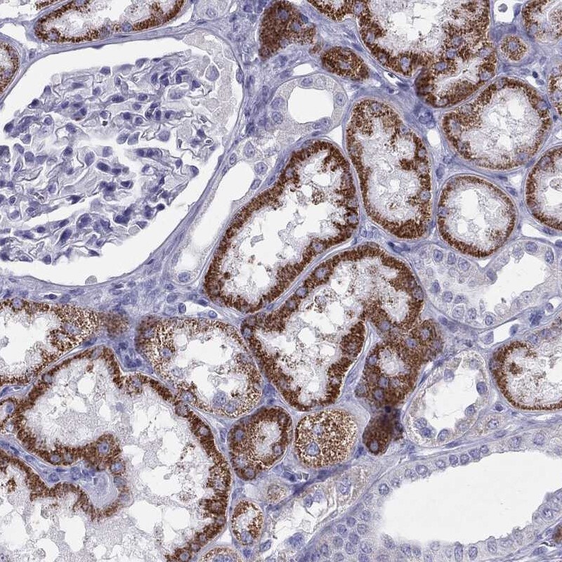 Immunohistochemistry-Paraffin: TRPM3 Antibody [NBP3-21371] -
