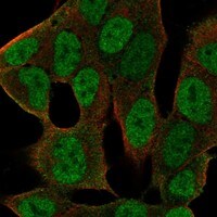 Immunocytochemistry/Immunofluorescence: Pygopus-2 Antibody [NBP3-21376] -