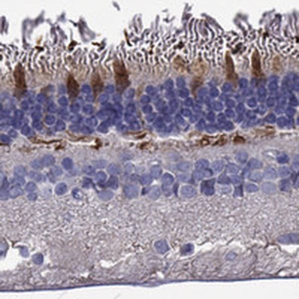 Immunohistochemistry-Paraffin: GRK7 Antibody [NBP3-21379] -