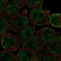 Immunocytochemistry/Immunofluorescence: beta-Arrestin 2 Antibody [NBP3-21381] -