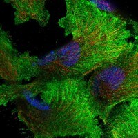 Immunocytochemistry/Immunofluorescence: Axl Antibody [NBP3-21382] -