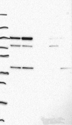 Western Blot: ADK Antibody [NBP3-21383] -
