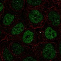 Immunocytochemistry/Immunofluorescence: S100P Antibody [NBP3-21384] -