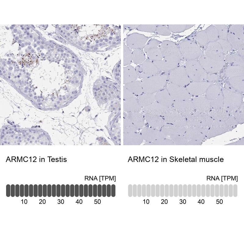 Immunohistochemistry-Paraffin: ARMC12 Antibody [NBP3-21386] -