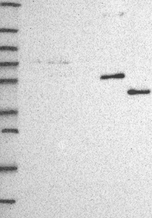 Western Blot: CYP3A7 Antibody [NBP3-21388] -