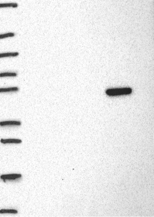 Western Blot: RBFOX3/NeuN Antibody [NBP3-21393] -