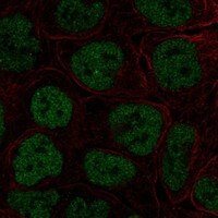 Immunocytochemistry/Immunofluorescence: TBX3 Antibody [NBP3-21394] -