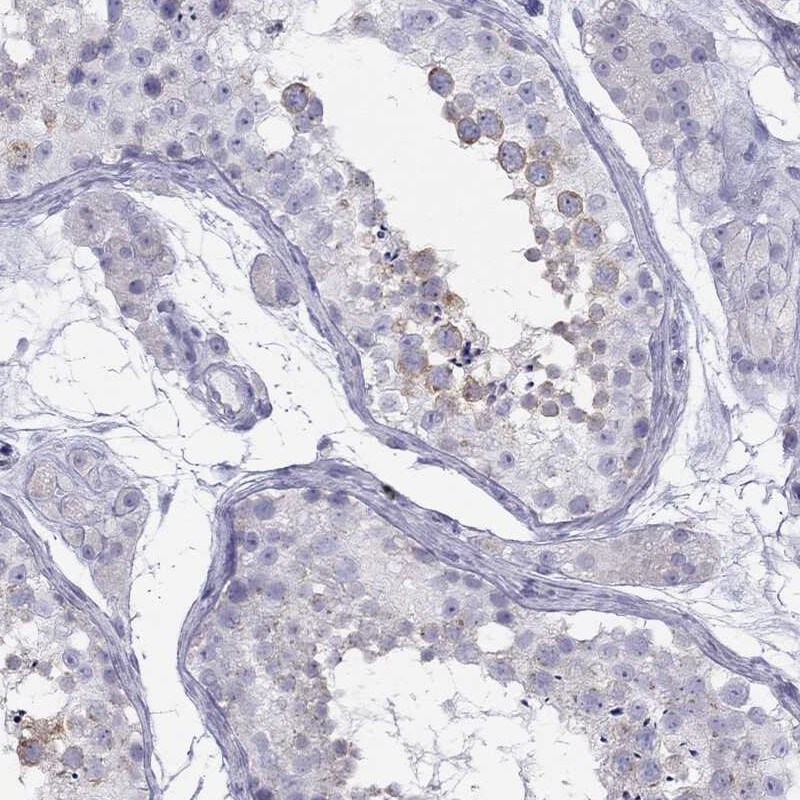 Immunohistochemistry-Paraffin: TDRD6 Antibody [NBP3-21396] -