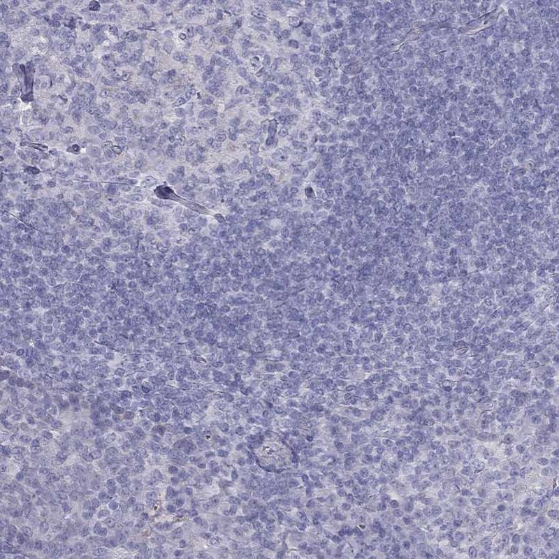 Immunohistochemistry-Paraffin: TDRD6 Antibody [NBP3-21396] -