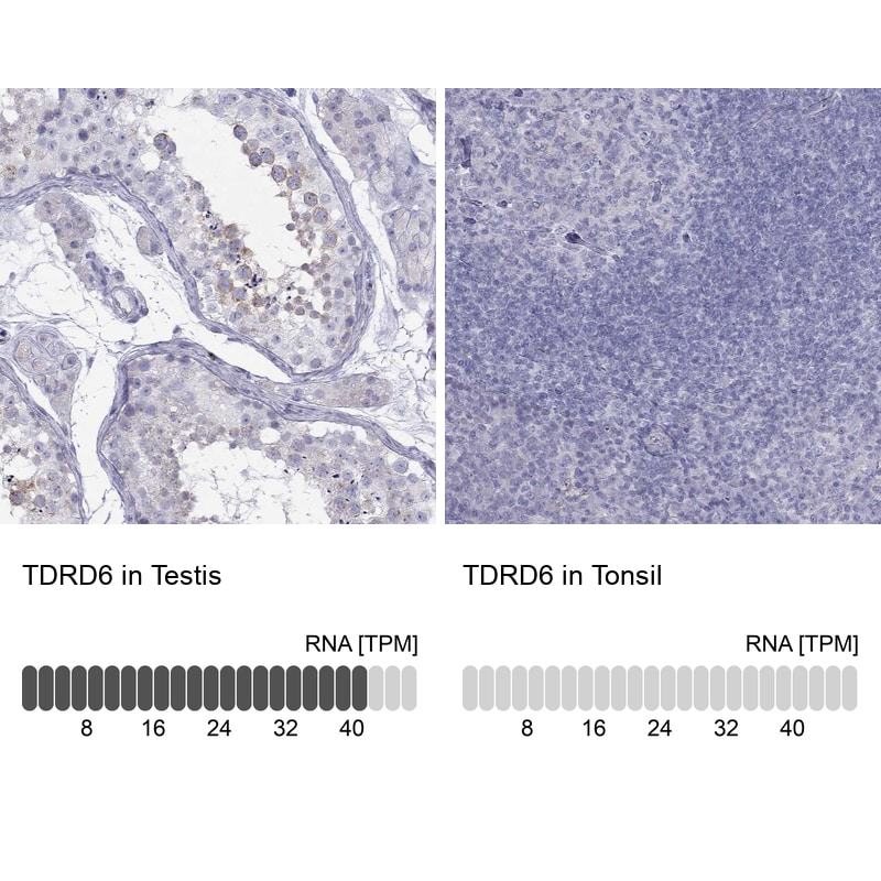 Immunohistochemistry-Paraffin: TDRD6 Antibody [NBP3-21396] -