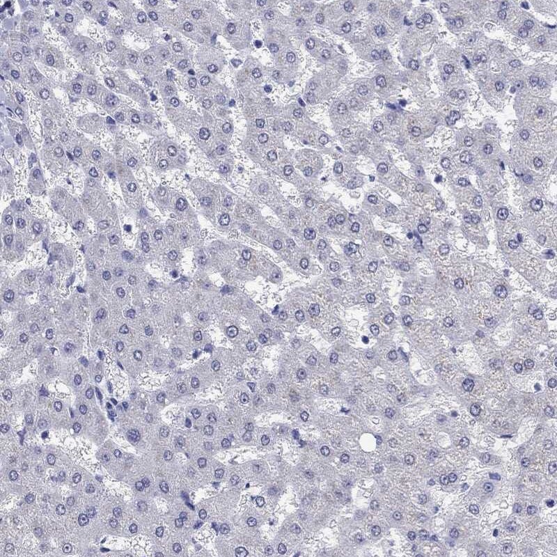 Immunohistochemistry-Paraffin: SH2D7 Antibody [NBP3-21405] -