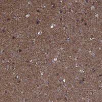 Immunohistochemistry-Paraffin: MAP1 Antibody [NBP3-21408] -