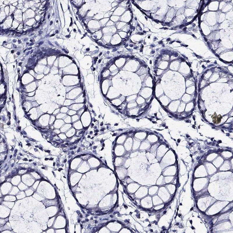 Immunohistochemistry-Paraffin: TP53TG5 Antibody [NBP3-21410] -