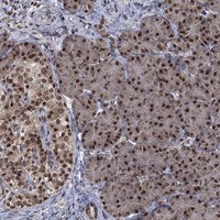 Immunohistochemistry-Paraffin: Fibrillarin Antibody [NBP3-21414] -