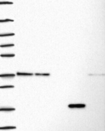 Western Blot: Fibrillarin Antibody [NBP3-21414] -