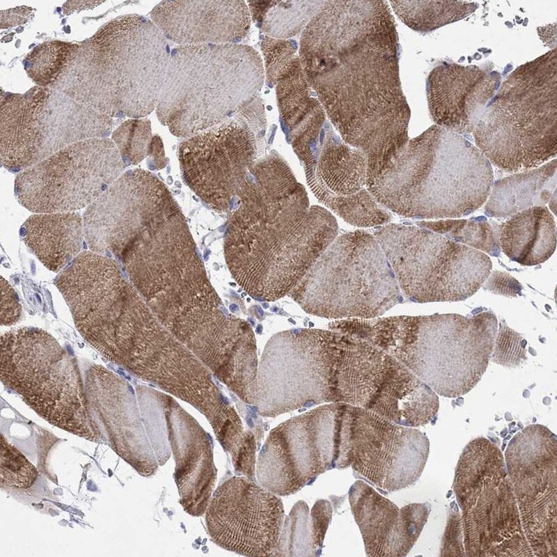 Immunohistochemistry-Paraffin: CMYA5 Antibody [NBP3-21415] -