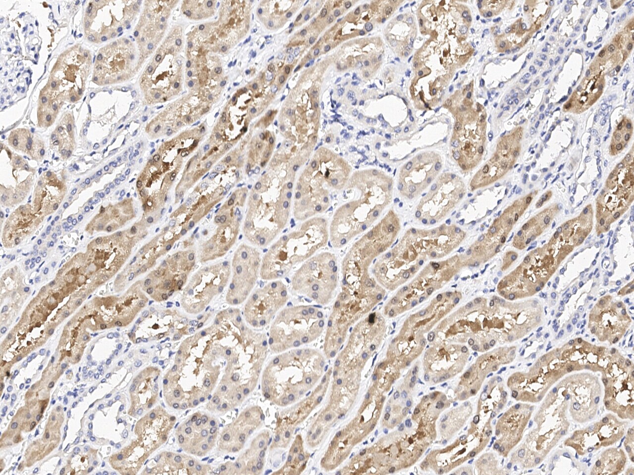ACY3 Antibody Immunohistochemistry-Paraffin: ACY3 Antibody [NBP3-21422]