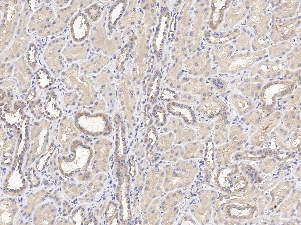 C12orf4 Antibody Immunohistochemistry-Paraffin: C12orf4 Antibody [NBP3-21423]