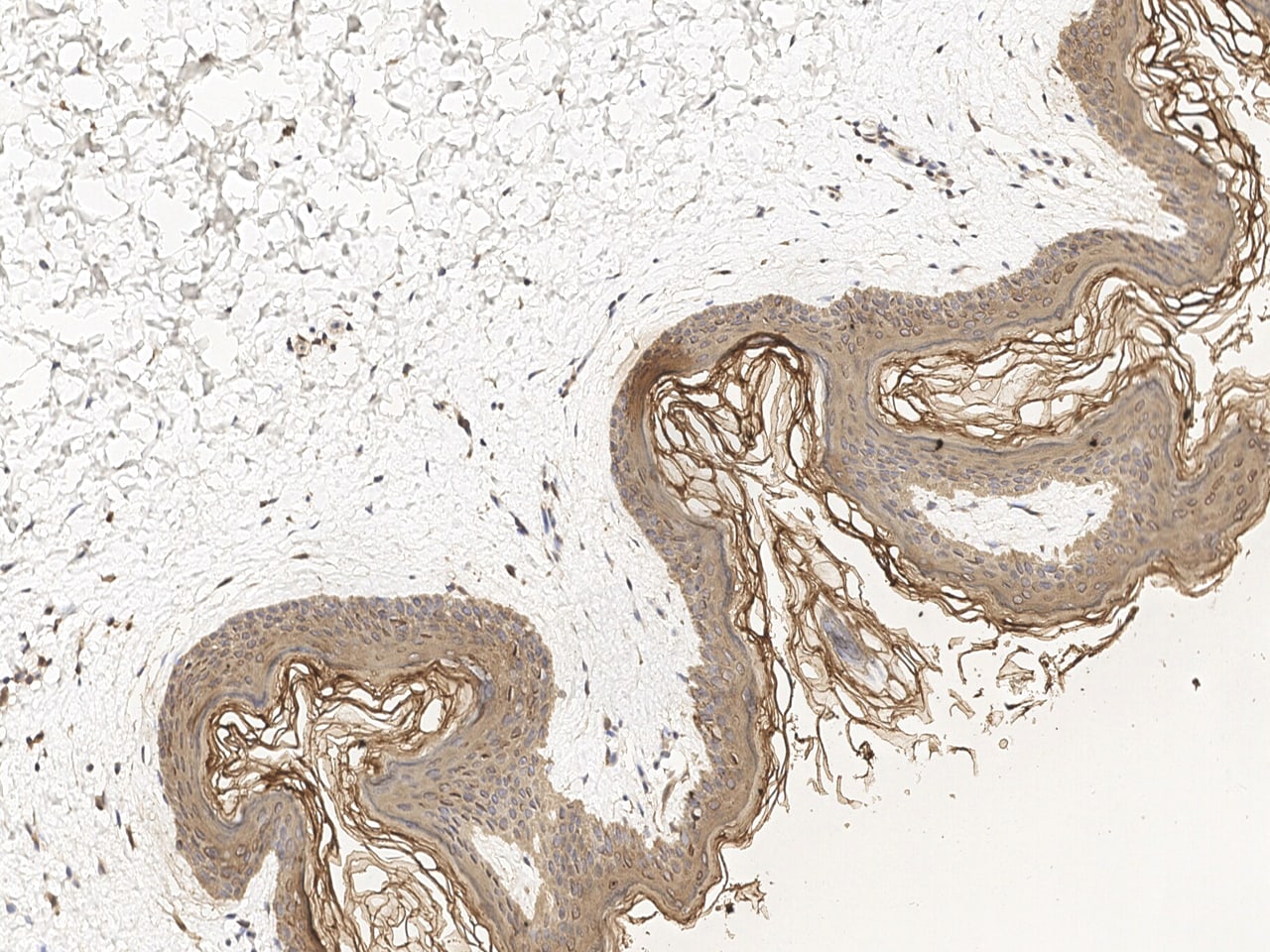 Cytokeratin 2 Antibody