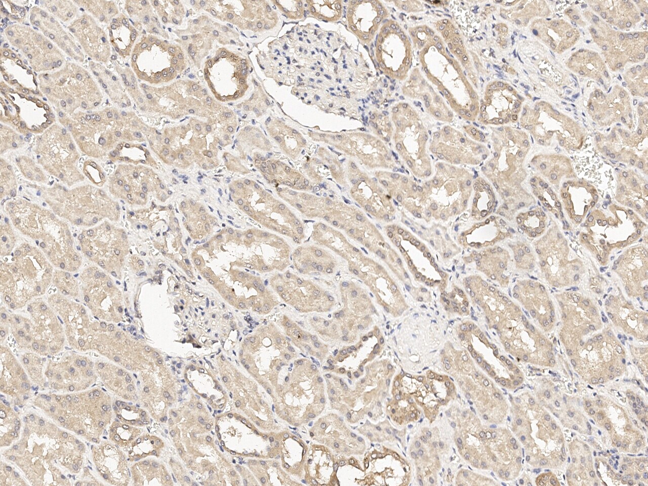 Tenascin X Antibody Immunohistochemistry-Paraffin: Tenascin X Antibody [NBP3-21427]