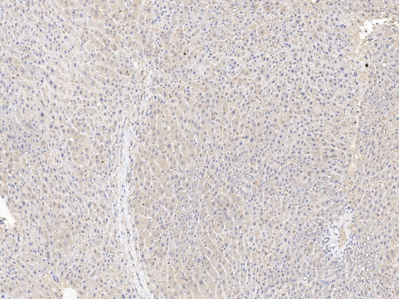 SHMT1 Antibody Immunohistochemistry-Paraffin: SHMT1 Antibody [NBP3-21429]