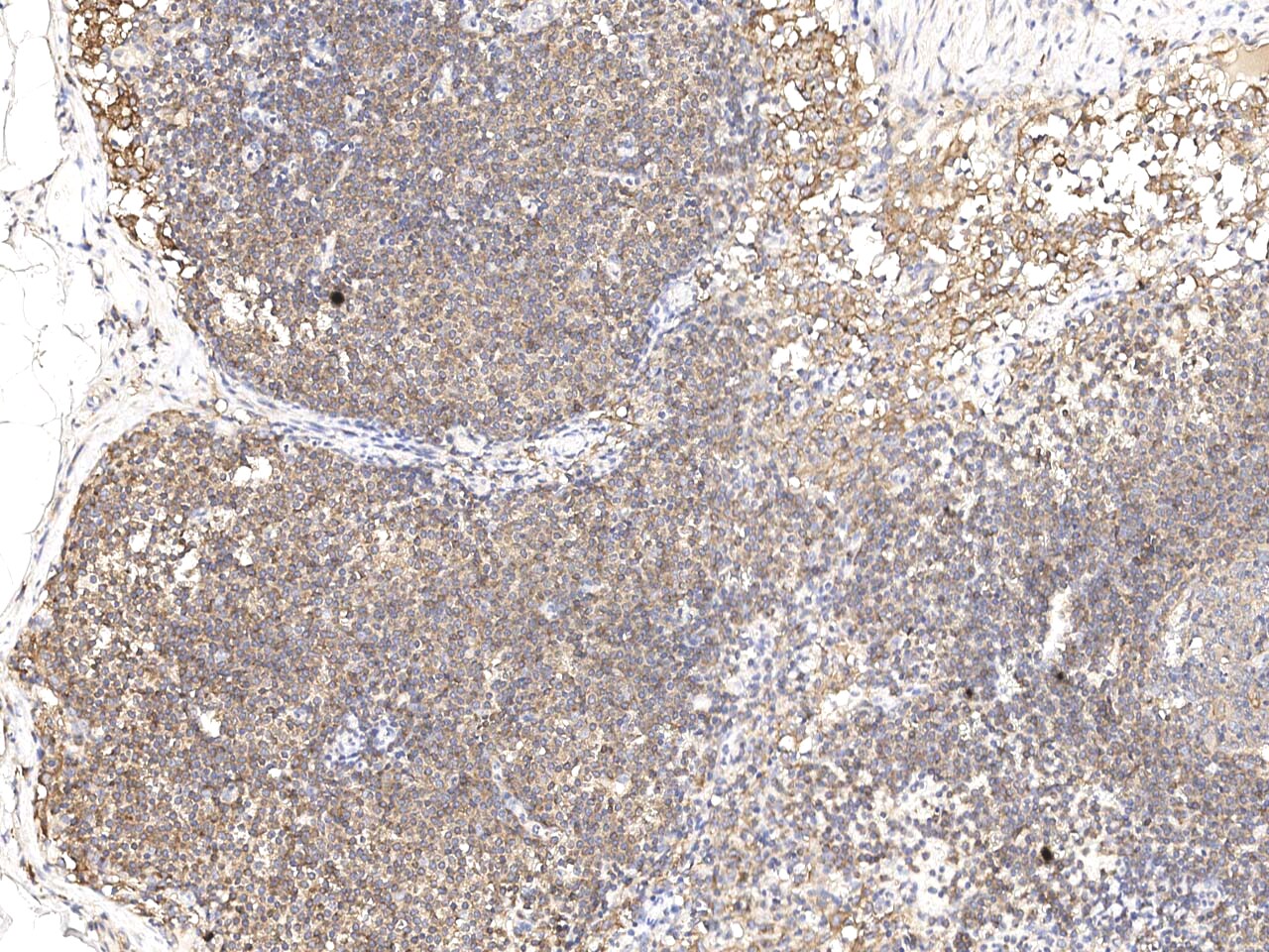 SNX2 Antibody Immunohistochemistry-Paraffin: SNX2 Antibody [NBP3-21430]