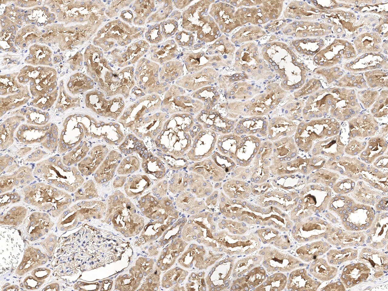 SNX2 Antibody