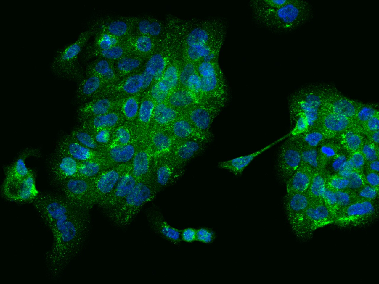 SNX2 Antibody - BSA Free