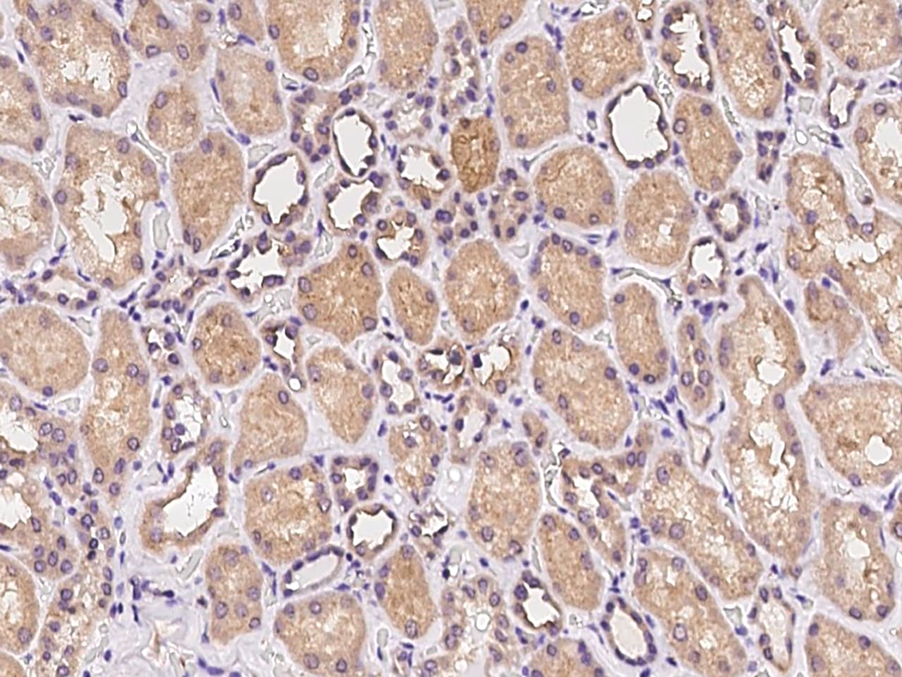 CoCoA Antibody Immunohistochemistry-Paraffin: CoCoA Antibody [NBP3-21437]