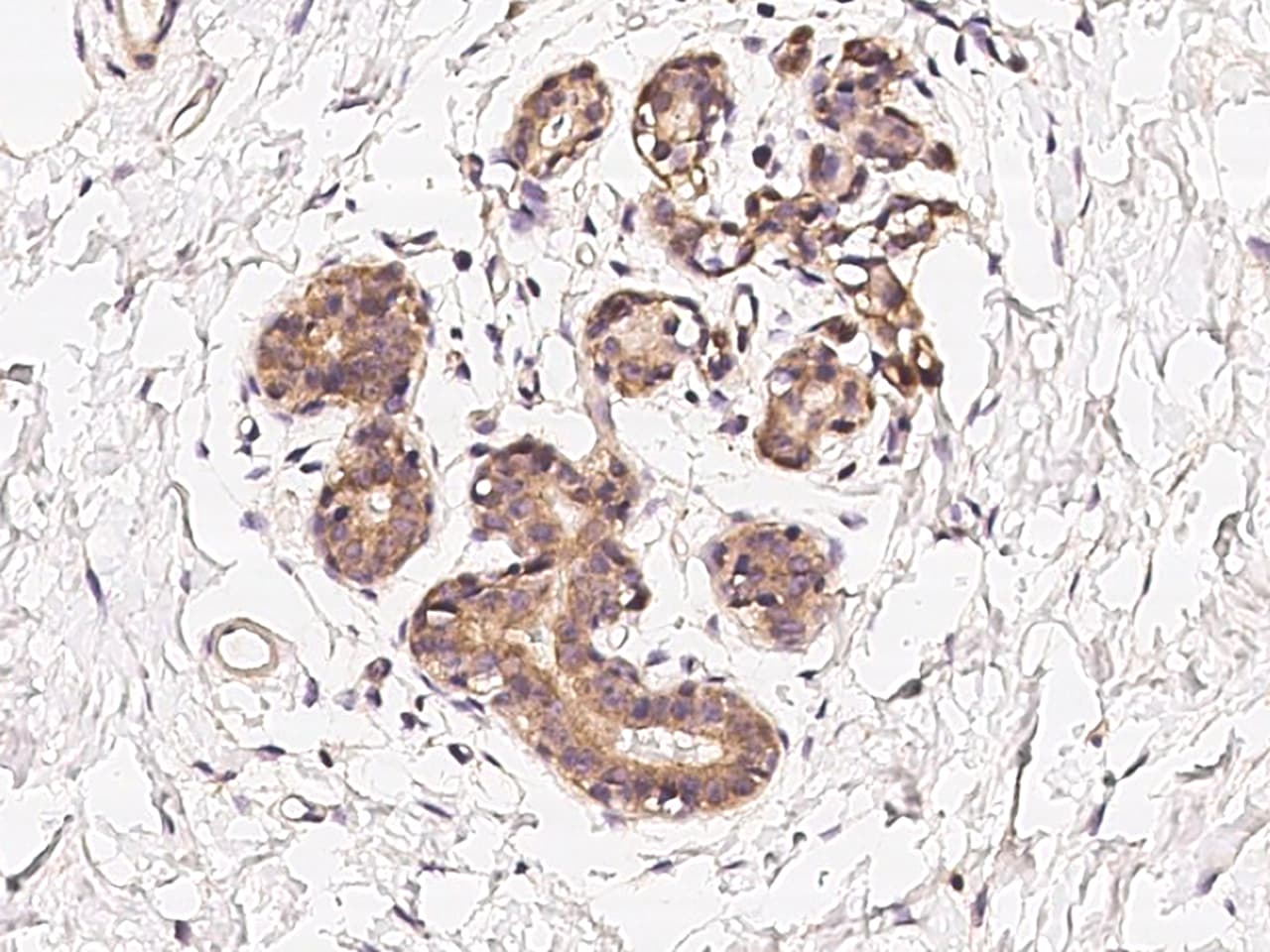 CoCoA Antibody Immunohistochemistry-Paraffin: CoCoA Antibody [NBP3-21437]